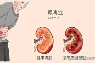 德甲-凯恩双响14轮轰20球&年度51球 拜仁3-0斯图加特距榜首4分